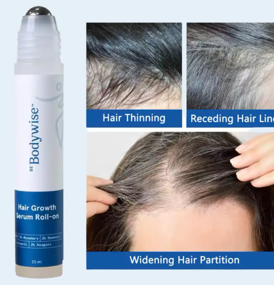 25Ml Hair Growth Essence Oil for Hair Care, Scalp Nourishment & Frizz Control 3% Rosemary Hair Serum